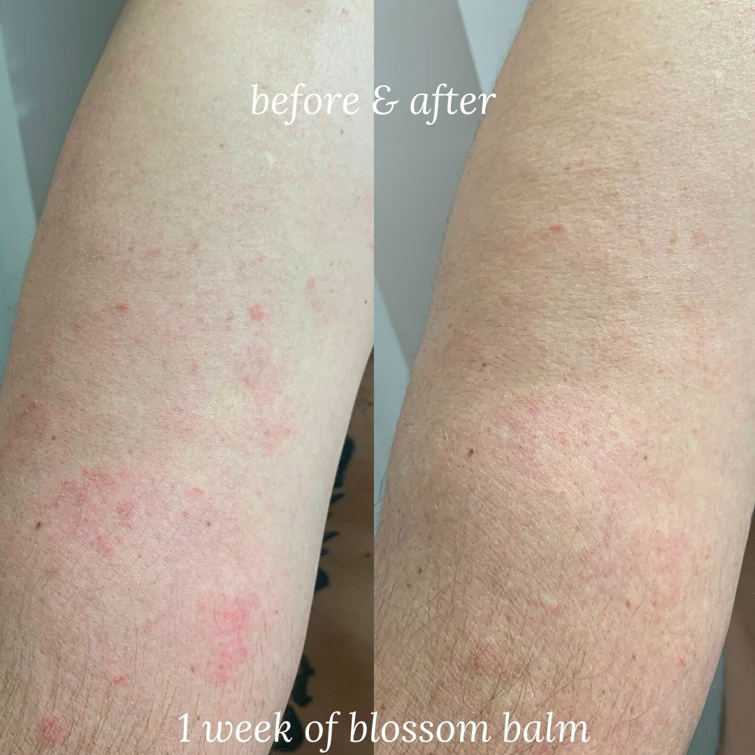 Blossom Balm · Multi-Use Balm